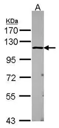 Anti-USP5 antibody [N1N3] used in Western Blot (WB). GTX115063