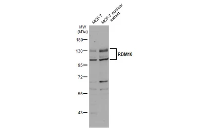 Anti-RBM10 antibody used in Western Blot (WB). GTX115074