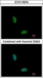 Anti-RBM10 antibody used in Immunocytochemistry/ Immunofluorescence (ICC/IF). GTX115074