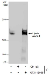 Anti-Liprin alpha 1 antibody [N1N2], N-term used in Immunoprecipitation (IP). GTX115098