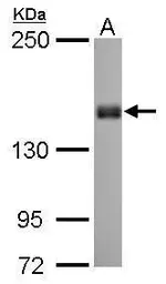 Anti-Liprin alpha 1 antibody [N1N2], N-term used in Western Blot (WB). GTX115098