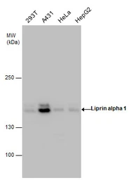 Anti-Liprin alpha 1 antibody [N1N2], N-term used in Western Blot (WB). GTX115098