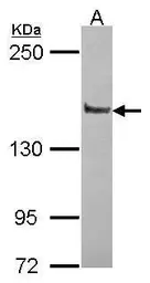 Anti-Liprin alpha 1 antibody [N1N2], N-term used in Western Blot (WB). GTX115098