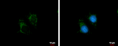 Anti-Stanniocalcin 2 antibody used in Immunocytochemistry/ Immunofluorescence (ICC/IF). GTX115113