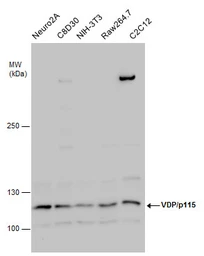 Anti-VDP / p115 antibody used in Western Blot (WB). GTX115115