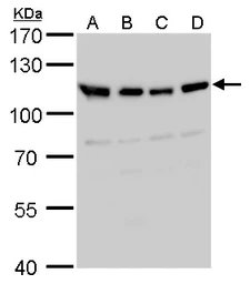 Anti-VDP / p115 antibody used in Western Blot (WB). GTX115115