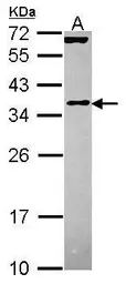 Anti-EIF3J antibody [N2C3] used in Western Blot (WB). GTX115121