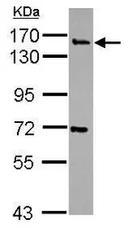 Anti-Synaptojanin 2 antibody [N3C1], Internal used in Western Blot (WB). GTX115153