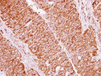 Anti-EIF2 beta antibody used in IHC (Paraffin sections) (IHC-P). GTX115156