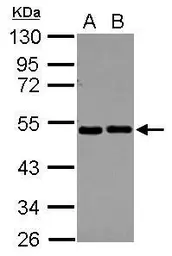 Anti-EIF2 beta antibody used in Western Blot (WB). GTX115156