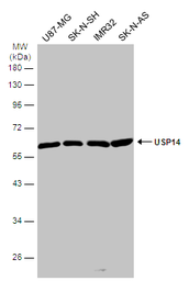 Anti-USP14 antibody used in Western Blot (WB). GTX115186