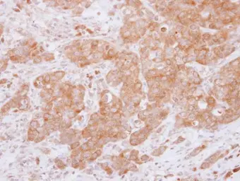 Anti-USP14 antibody used in IHC (Paraffin sections) (IHC-P). GTX115186