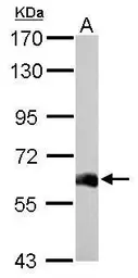 Anti-USP14 antibody used in Western Blot (WB). GTX115186