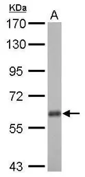 Anti-USP14 antibody used in Western Blot (WB). GTX115186