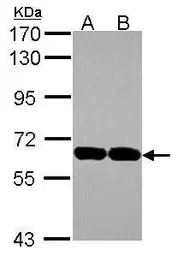 Anti-USP14 antibody used in Western Blot (WB). GTX115186