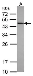 Anti-GRP1 antibody [N3C3] used in Western Blot (WB). GTX115211