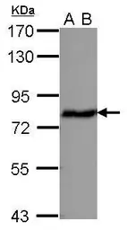 Anti-ERP72 antibody used in Western Blot (WB). GTX115263