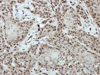 Anti-CTR9 antibody [N1N2], N-term used in IHC (Paraffin sections) (IHC-P). GTX115267