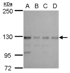 Anti-CTR9 antibody [N1N2], N-term used in Western Blot (WB). GTX115267