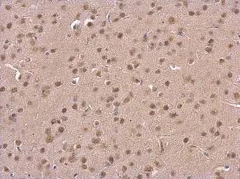 Anti-PSMD6 antibody used in IHC (Paraffin sections) (IHC-P). GTX115303