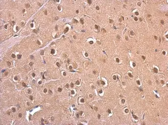 Anti-PSMD6 antibody used in IHC (Paraffin sections) (IHC-P). GTX115303