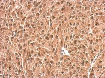 Anti-PSMD6 antibody used in IHC (Paraffin sections) (IHC-P). GTX115303