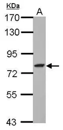 Anti-GFPT2 antibody used in Western Blot (WB). GTX115319