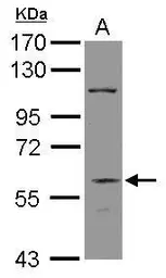 Anti-DGCR2 antibody [N2C1], Internal used in Western Blot (WB). GTX115329