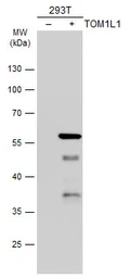 Anti-TOM1L1 antibody [N2C2], Internal used in Western Blot (WB). GTX115333