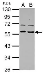 Anti-TOM1L1 antibody [N2C2], Internal used in Western Blot (WB). GTX115333