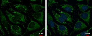 Anti-TRAP1 antibody [N1N3] used in Immunocytochemistry/ Immunofluorescence (ICC/IF). GTX115352