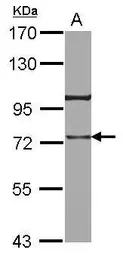 Anti-TRAP1 antibody [N1N3] used in Western Blot (WB). GTX115352