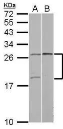 Anti-YAF2 antibody used in Western Blot (WB). GTX115355