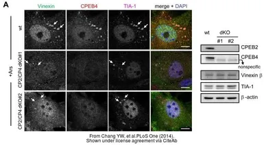 Anti-Vinexin antibody [N3C2], Internal used in Immunocytochemistry/ Immunofluorescence (ICC/IF). GTX115362