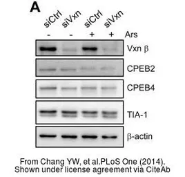 Anti-Vinexin antibody [N3C2], Internal used in Western Blot (WB). GTX115362