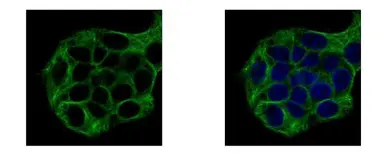 Anti-Vinexin antibody [N3C2], Internal used in Immunocytochemistry/ Immunofluorescence (ICC/IF). GTX115362