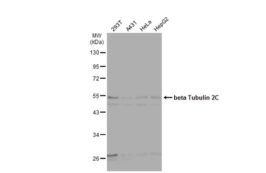 Anti-beta Tubulin 2C antibody [C1C3] used in Western Blot (WB). GTX115404