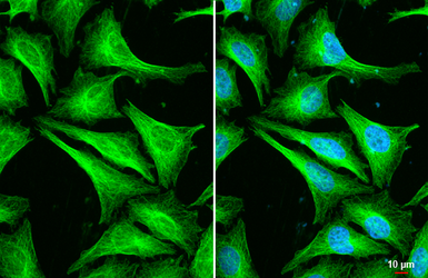 Anti-beta Tubulin 2C antibody [C1C3] used in Immunocytochemistry/ Immunofluorescence (ICC/IF). GTX115404