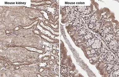 Anti-beta Tubulin 2C antibody [C1C3] used in IHC (Paraffin sections) (IHC-P). GTX115404