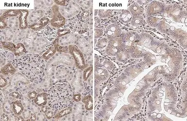 Anti-beta Tubulin 2C antibody [C1C3] used in IHC (Paraffin sections) (IHC-P). GTX115404