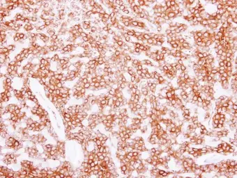 Anti-beta Tubulin 2C antibody [C1C3] used in IHC (Paraffin sections) (IHC-P). GTX115404