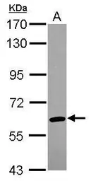 Anti-ARIH2 antibody [C1C3] used in Western Blot (WB). GTX115411