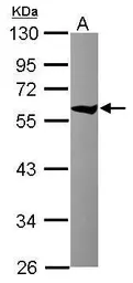 Anti-TCP1 theta antibody used in Western Blot (WB). GTX115466