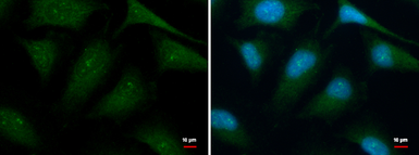 Anti-HBS1L antibody used in Immunocytochemistry/ Immunofluorescence (ICC/IF). GTX115474