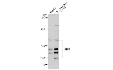 Anti-BRD8 antibody [C1C2], Internal used in Western Blot (WB). GTX115500