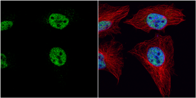 Anti-PRDM4 antibody used in Immunocytochemistry/ Immunofluorescence (ICC/IF). GTX115579
