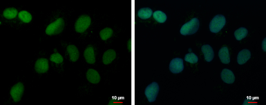 Anti-PRDM4 antibody used in Immunocytochemistry/ Immunofluorescence (ICC/IF). GTX115579
