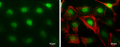 Anti-MTF2 antibody used in Immunocytochemistry/ Immunofluorescence (ICC/IF). GTX115634