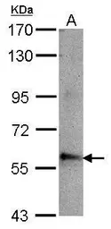 Anti-ABLIM3 antibody [C1C3] used in Western Blot (WB). GTX115642