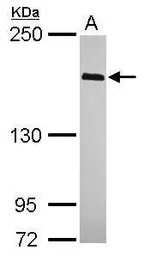 Anti-WAPL antibody [C1C3] used in Western Blot (WB). GTX115664